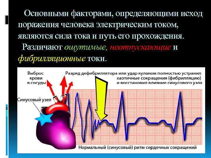 Основными факторами, определяющими исход поражения человека электрическим током, являются сила тока и путь его