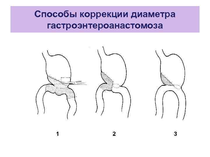 Галавит при эндометрите схема