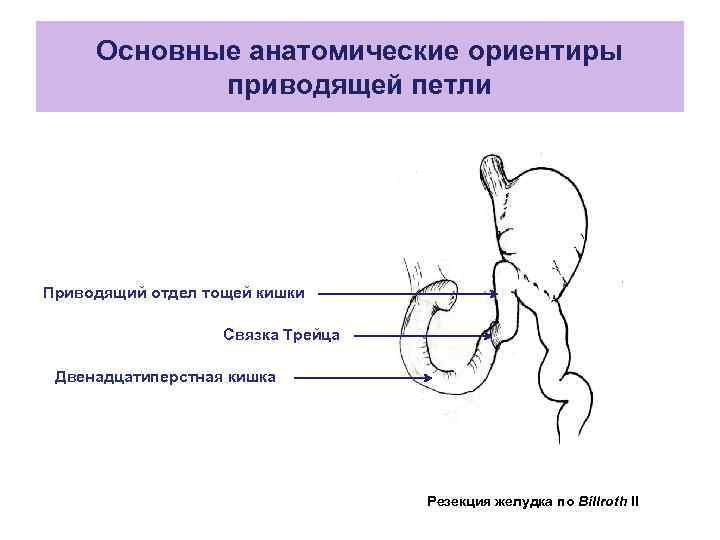 Результаты после резекции желудка фото