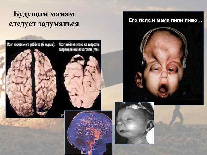Будущим мамам следует задуматься 