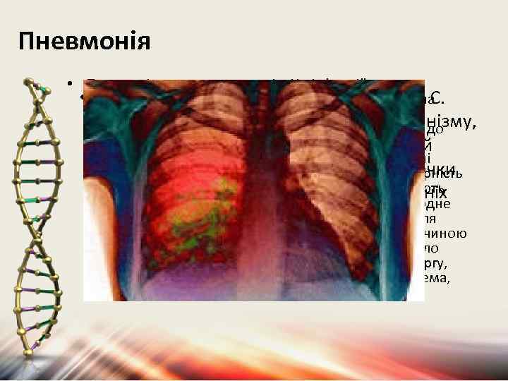 Пневмонія • Пневмонія-запалення легенів. Це інфекційне • захворювання легень, що виникає або як самостійна