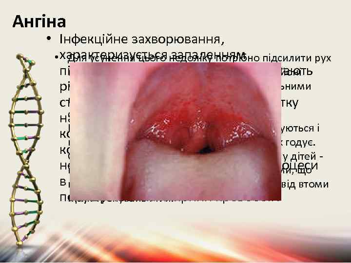 Ангіна • Інфекційне захворювання, • характеризується запаленням Для усунення цього недоліку потрібно підсилити рух