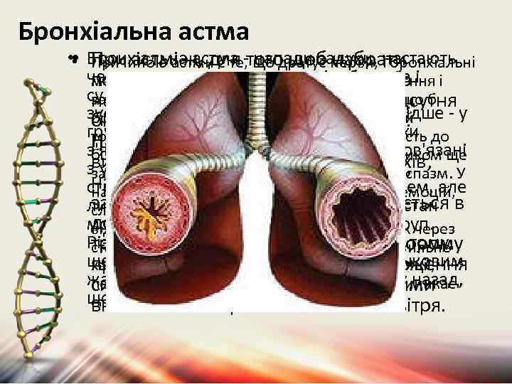 Бронхіальна астма • • Бронхіальна астма - напади задухи, настають • При астмі ж,