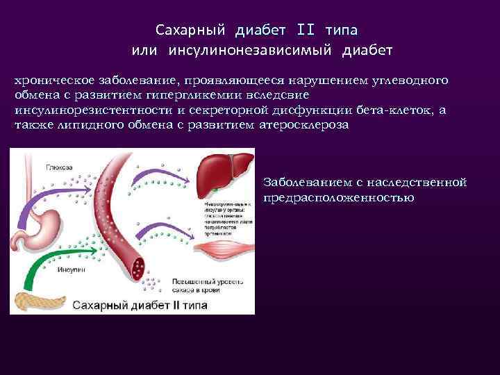 Сахарный диабет II типа или инсулинонезависимый диабет хроническое заболевание, проявляющееся нарушением углеводного обмена с