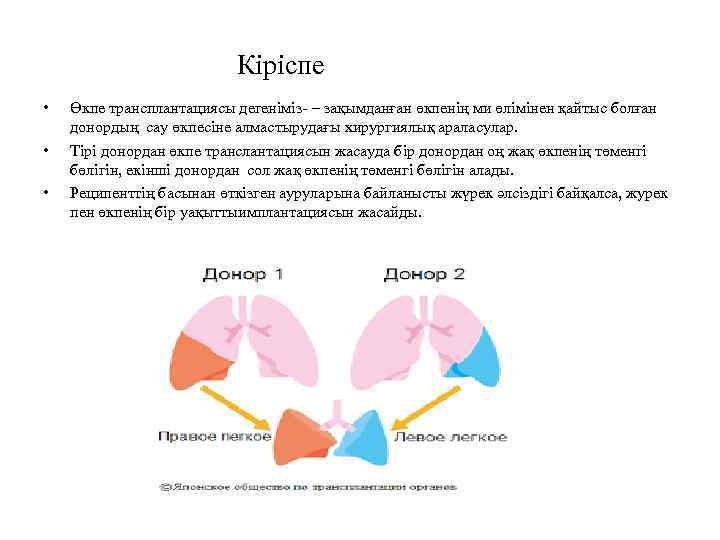 Кіріспе • • • Өкпе трансплантациясы дегеніміз- – зақымданған өкпенің ми өлімінен қайтыс болған