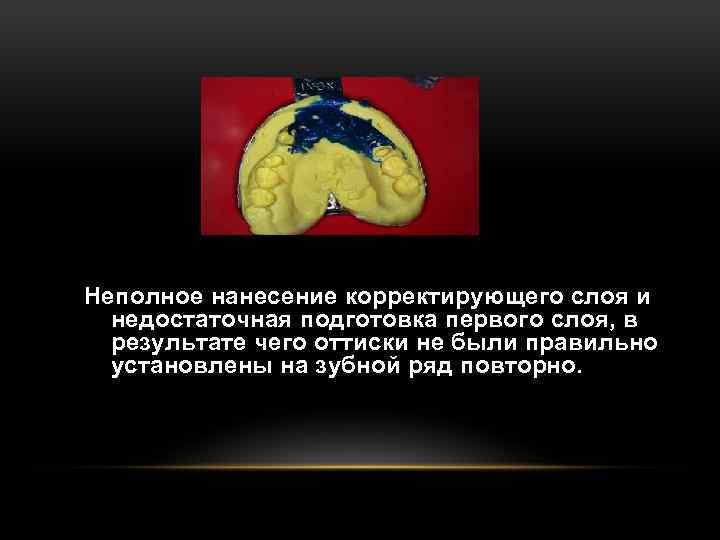 Неполное нанесение корректирующего слоя и недостаточная подготовка первого слоя, в результате чего оттиски не