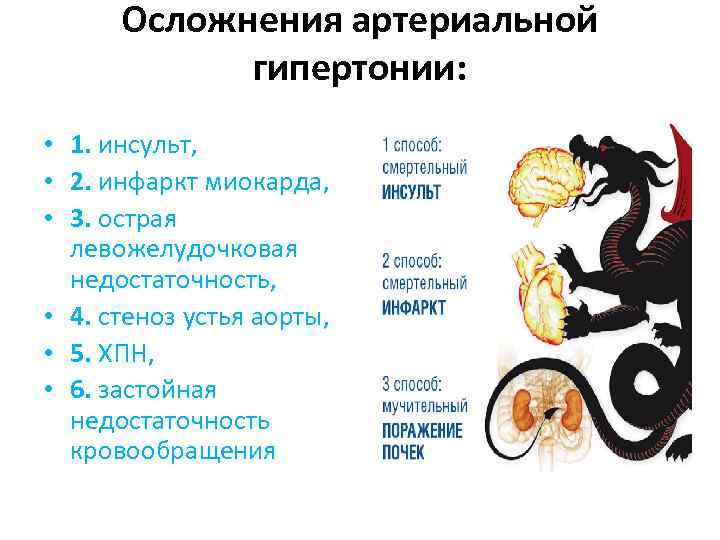 Осложнения артериальной гипертонии: • 1. инсульт, • 2. инфаркт миокарда, • 3. острая левожелудочковая