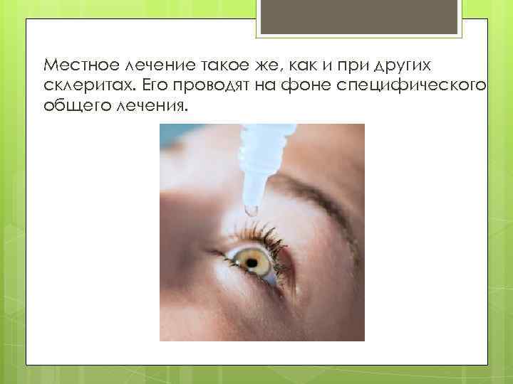 Местное лечение такое же, как и при других склеритах. Его проводят на фоне специфического