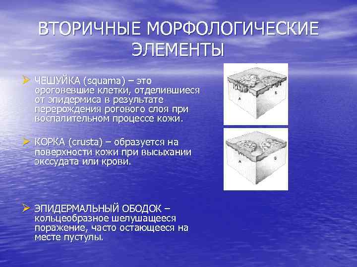 ВТОРИЧНЫЕ МОРФОЛОГИЧЕСКИЕ ЭЛЕМЕНТЫ Ø ЧЕШУЙКА (squama) – это ороговевшие клетки, отделившиеся от эпидермиса в