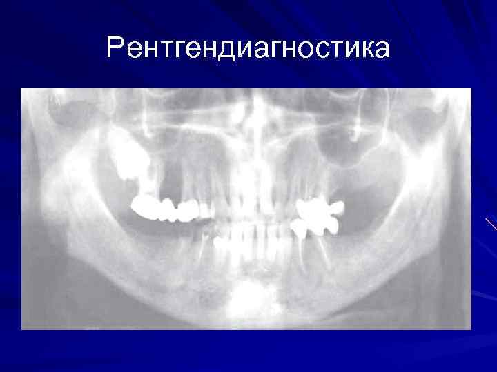 Рентгендиагностика 