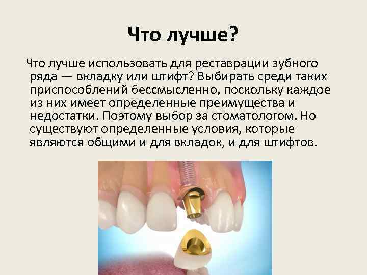 Что лучше? Что лучше использовать для реставрации зубного ряда — вкладку или штифт? Выбирать