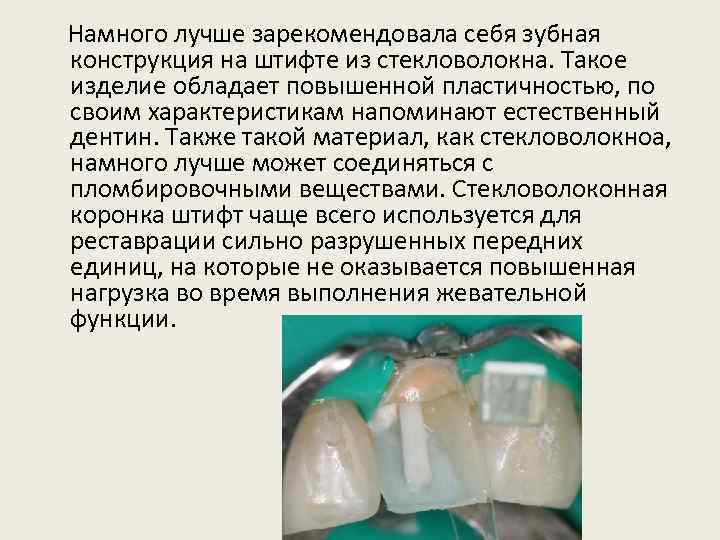  Намного лучше зарекомендовала себя зубная конструкция на штифте из стекловолокна. Такое изделие обладает