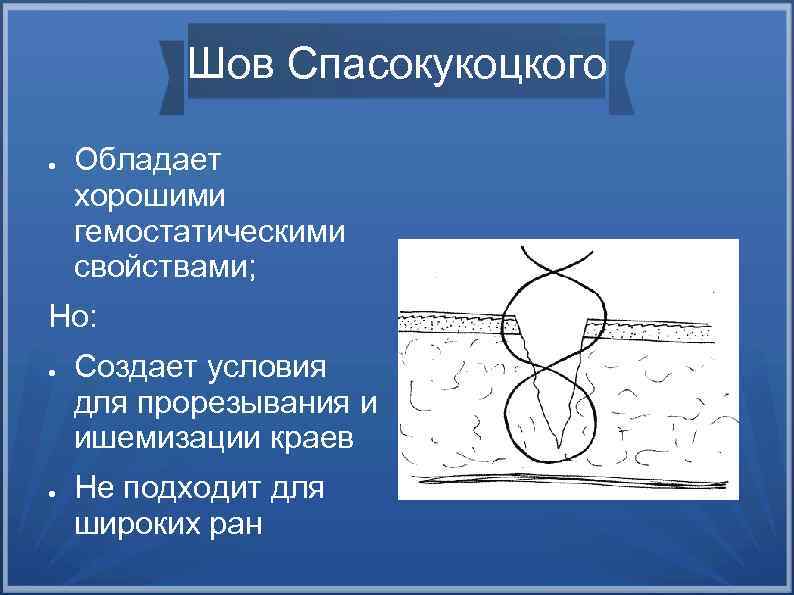 Швы в хирургии презентация