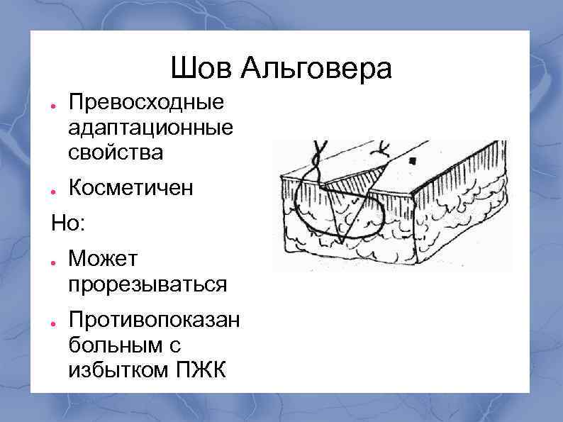 Шов Альговера ● ● Превосходные адаптационные свойства Косметичен Но: ● ● Может прорезываться Противопоказан