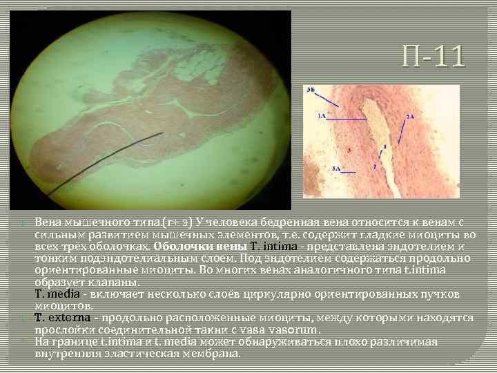 П-11 Вена мышечного типа. (г+ э) У человека бедренная вена относится к венам с