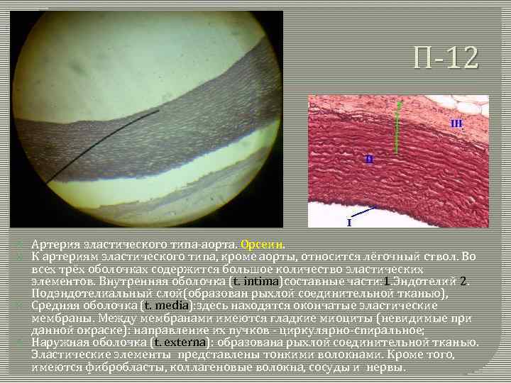 Рисунок артерия эластического типа