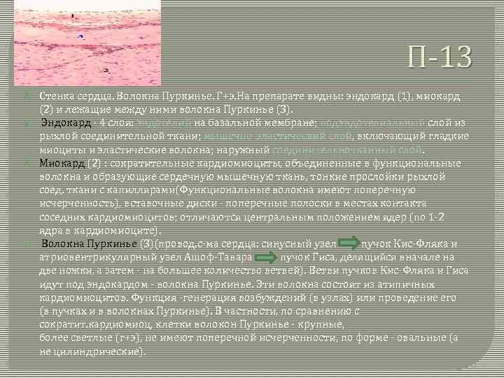 П-13 Стенка сердца. Волокна Пуркинье. Г+э. На препарате видны: эндокард (1), миокард (2) и