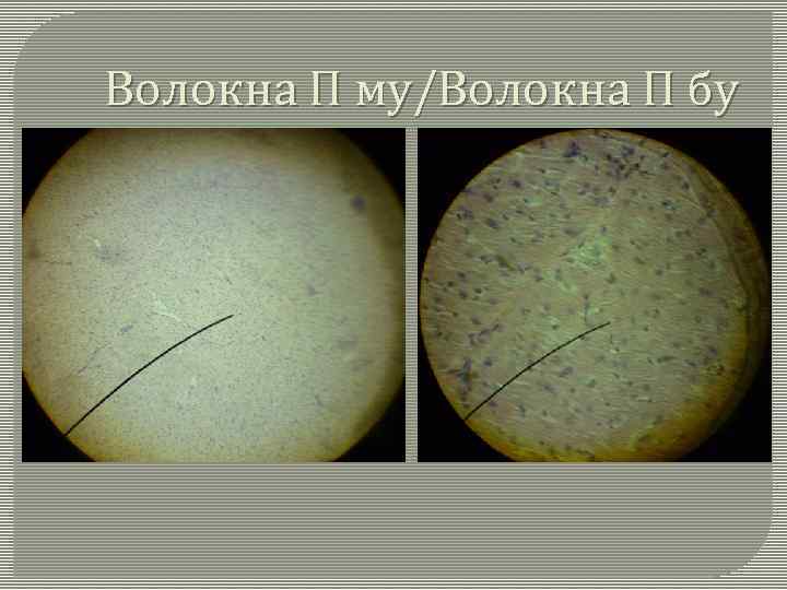 Волокна П му/Волокна П бу 