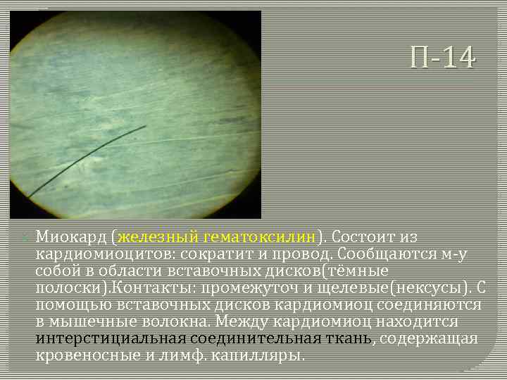 П-14 Миокард (железный гематоксилин). Состоит из кардиомиоцитов: сократит и провод. Сообщаются м-у собой в