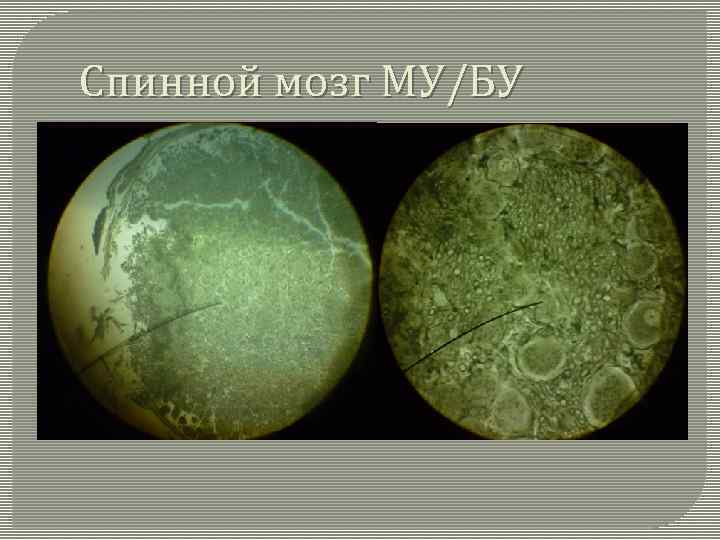 Спинной мозг МУ/БУ 