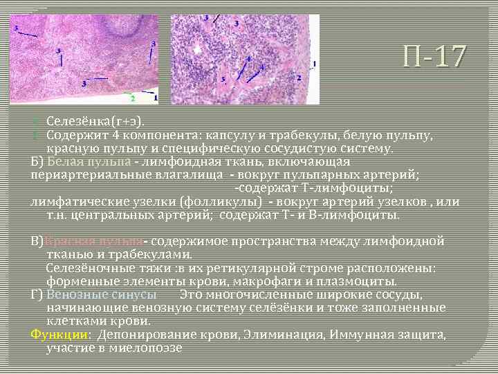 П-17 Селезёнка(г+э). Содержит 4 компонента: капсулу и трабекулы, белую пульпу, красную пульпу и специфическую