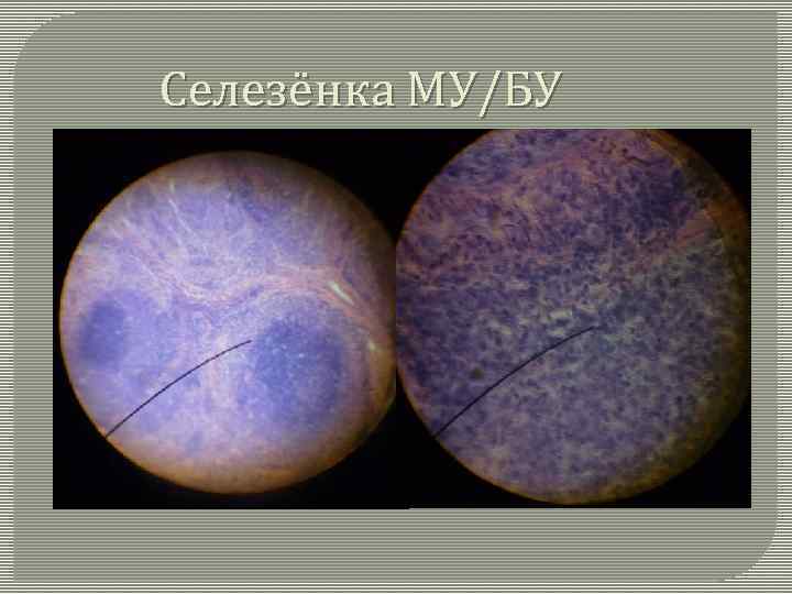Селезёнка МУ/БУ 