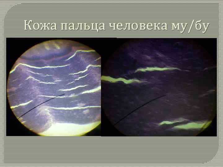 Кожа пальца человека му/бу 