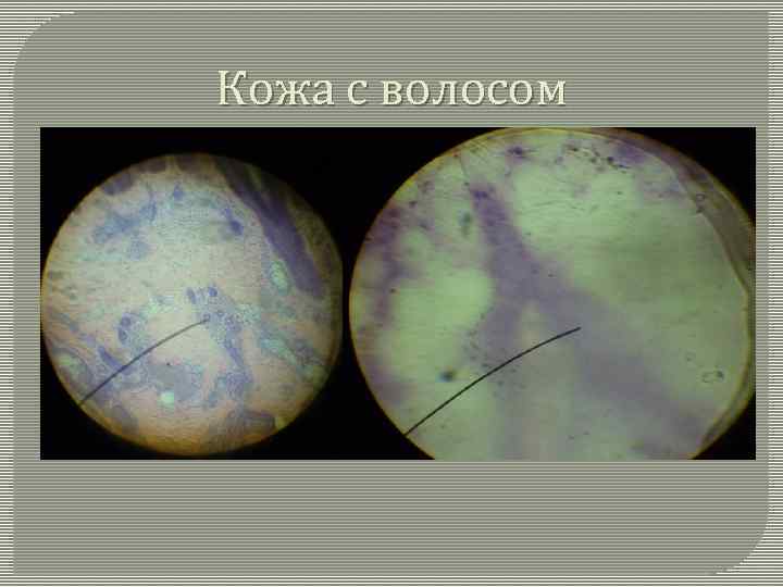 Кожа с волосом 