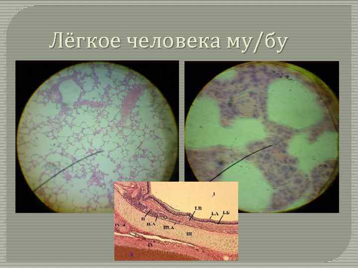 Лёгкое человека му/бу 