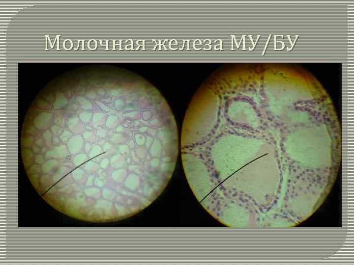 Молочная железа МУ/БУ 