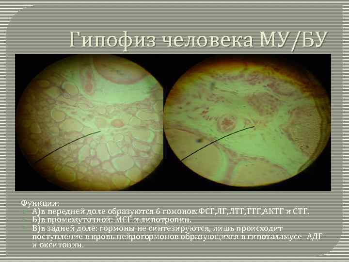 Гипофиз человека МУ/БУ Функции: А)в передней доле образуются 6 гомонов: ФСГ, ЛТГ, ТТГ, АКТГ