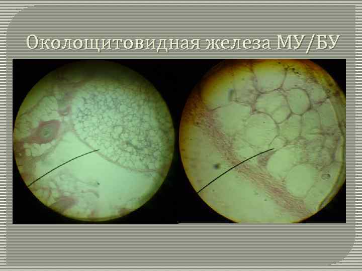 Околощитовидная железа МУ/БУ 