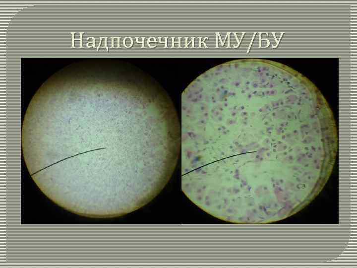 Надпочечник МУ/БУ 