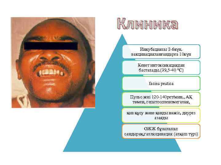 Клиника Инкубациясы 2 -6 күн. вакцинацияланғандарға 10 күн Кенет интоксикациядан басталады. (39, 5 -40