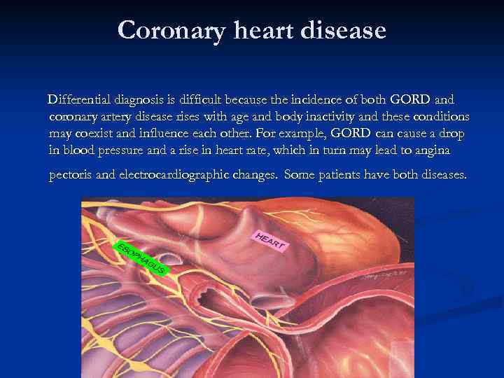 Coronary heart disease Differential diagnosis is difficult because the incidence of both GORD and