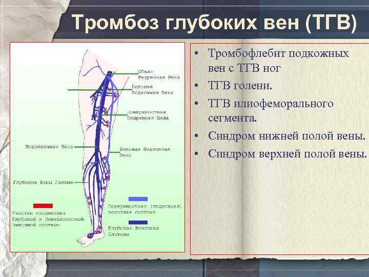 Тромбоз глубоких вен (ТГВ) • Тромбофлебит подкожных вен с ТГВ ног • ТГВ голени.