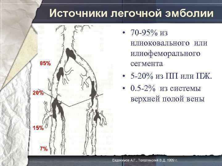 Источники легочной эмболии 85% 20% • 70 -95% из илиоковального илиофеморального сегмента • 5