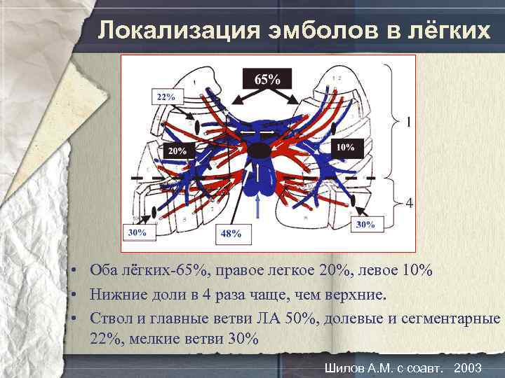 Локализация эмболов в лёгких • Оба лёгких-65%, правое легкое 20%, левое 10% • Нижние