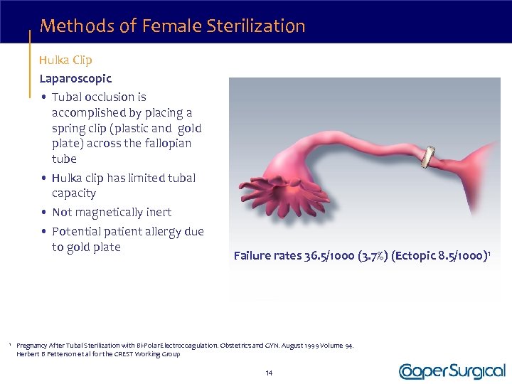 Methods of Female Sterilization Hulka Clip Laparoscopic • Tubal occlusion is accomplished by placing