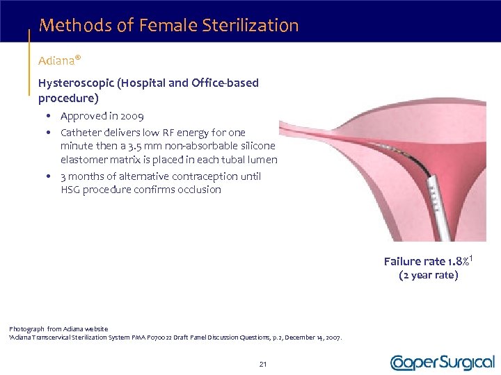Methods of Female Sterilization Adiana® Hysteroscopic (Hospital and Office-based procedure) • Approved in 2009