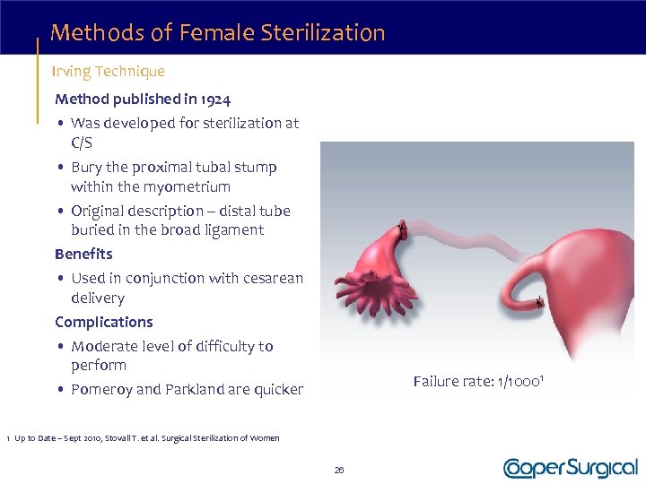 Methods of Female Sterilization Irving Technique Method published in 1924 • Was developed for