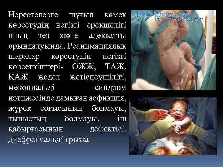 Нәрестелерге шұғыл көмек көрсетудің негізгі ерекшелігі оның тез және адекватты орындалуында. Реанимациялық шаралар көрсетудің