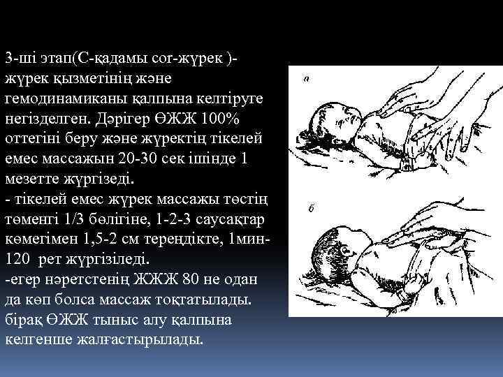 3 -ші этап(С-қадамы cor-жүрек )жүрек қызметінің және гемодинамиканы қалпына келтіруге негізделген. Дәрігер ӨЖЖ 100%