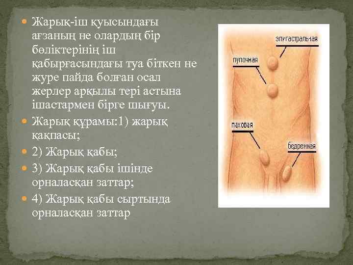  Жарық-іш қуысындағы ағзаның не олардың бір бөліктерінің іш қабырғасындағы туа біткен не журе