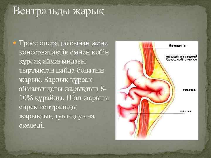 Вентральды жарық Гросс операциясынан және консервативтік емнен кейін құрсақ аймағындағы тыртықтан пайда болатын жарық.