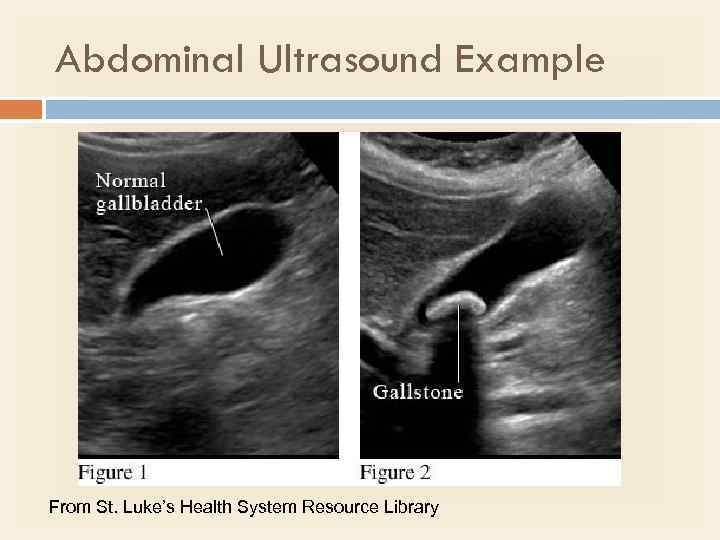 Abdominal Ultrasound Example From St. Luke’s Health System Resource Library 