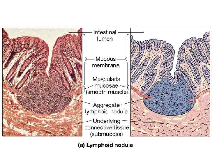 Lymph Nodules 