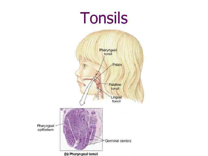 Tonsils 