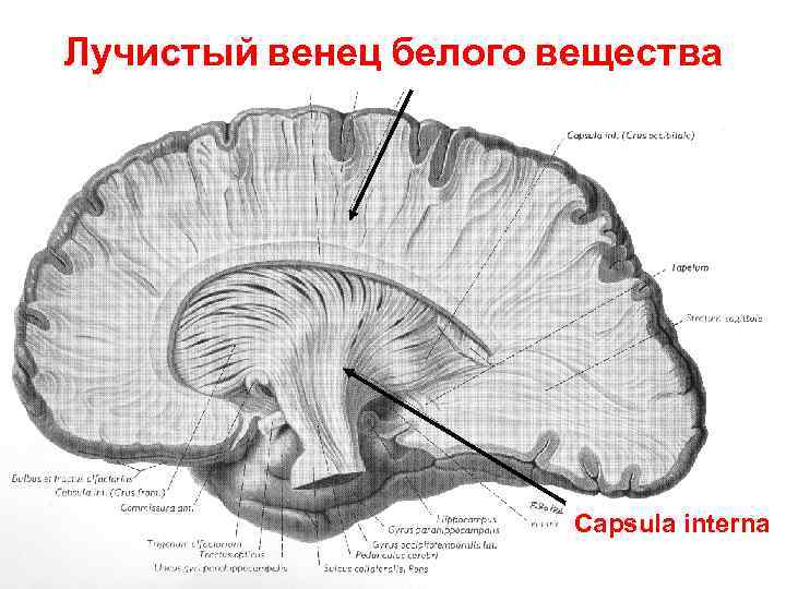 Лучистый венец белого вещества Capsula interna 