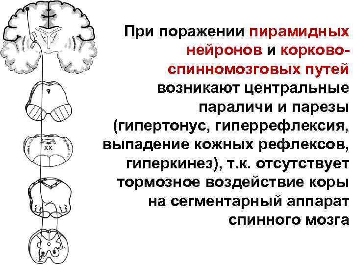 При поражении пирамидных нейронов и корковоспинномозговых путей возникают центральные параличи и парезы (гипертонус, гиперрефлексия,